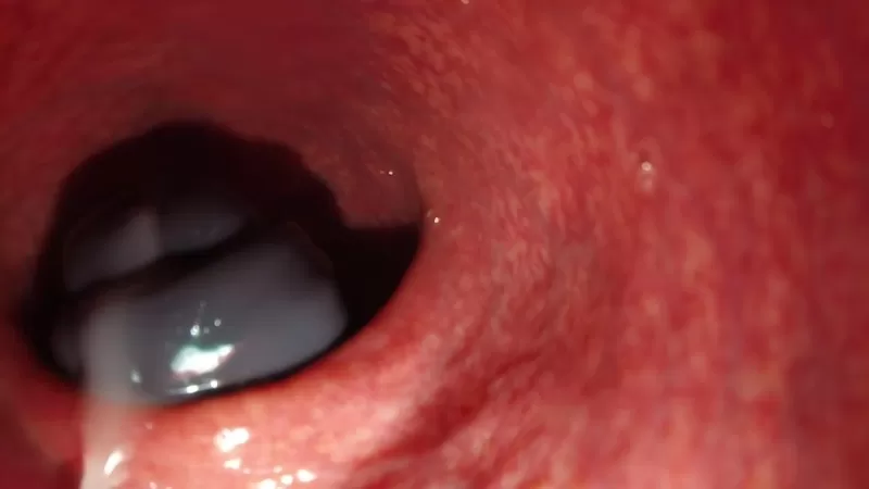 Камера внутри вагины после внутреннего кремпая, и бритье киски (Профессиональный ролик)