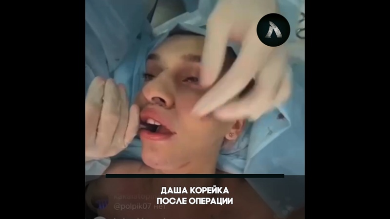 Порно делают операции на пизду крупным планом (55 фото) - порно chelmass.ru